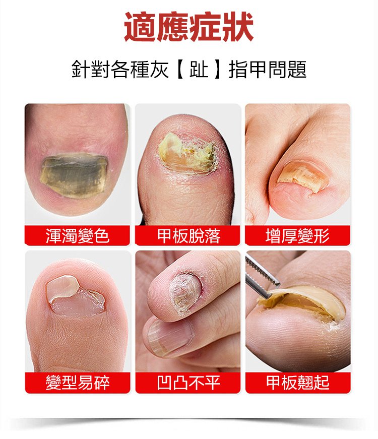 日本灰甲康保健液