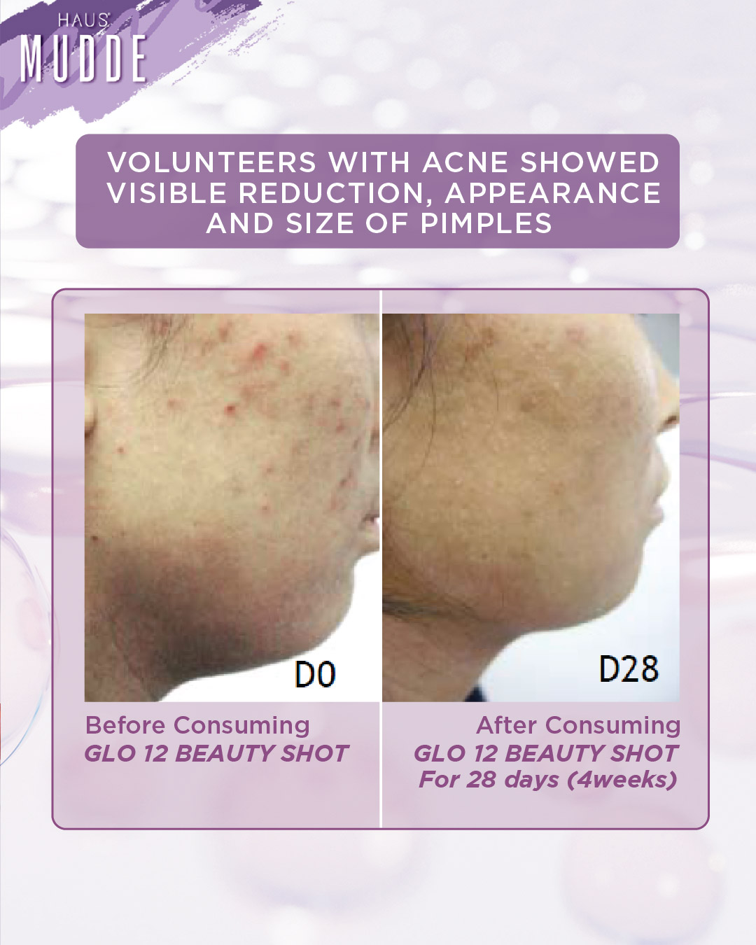 MUDDE - GLO12 BEAUTY SHOT