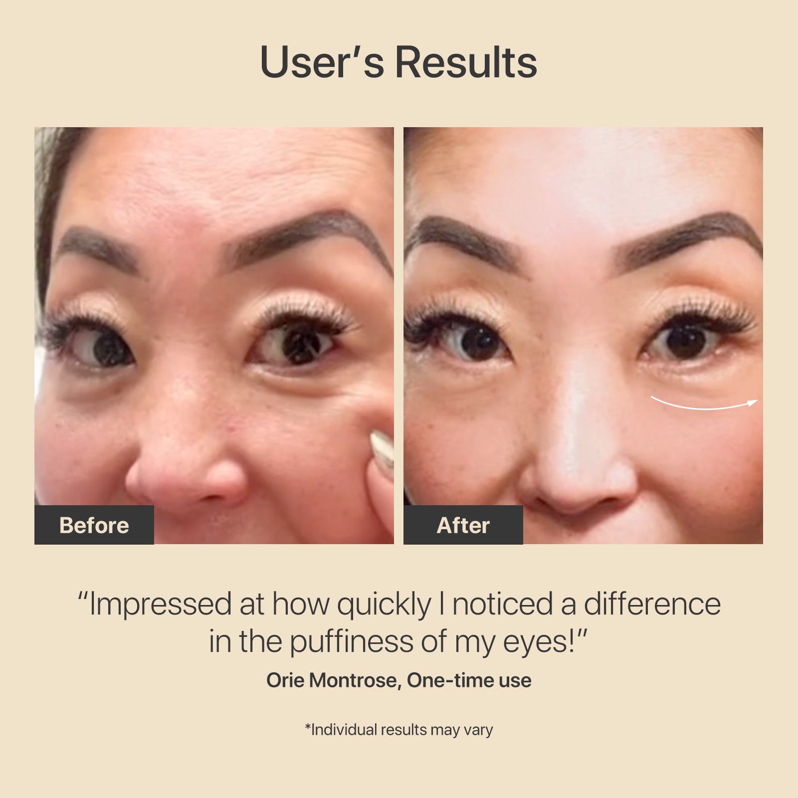 AMIRO R3 Turbo Facial RF Skin Tightening Device "Chinese Version"