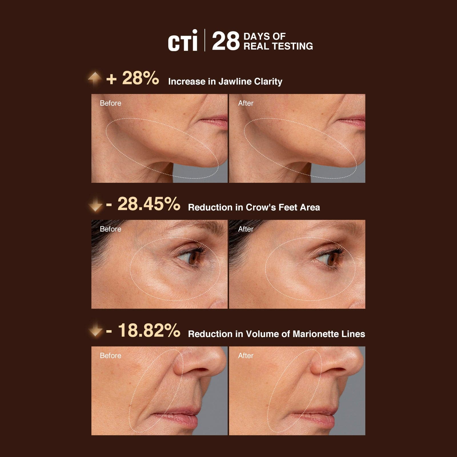 AMIRO U1 UltraLift Skin-Lifting Ultrasound Home Device (Mandarin Version)