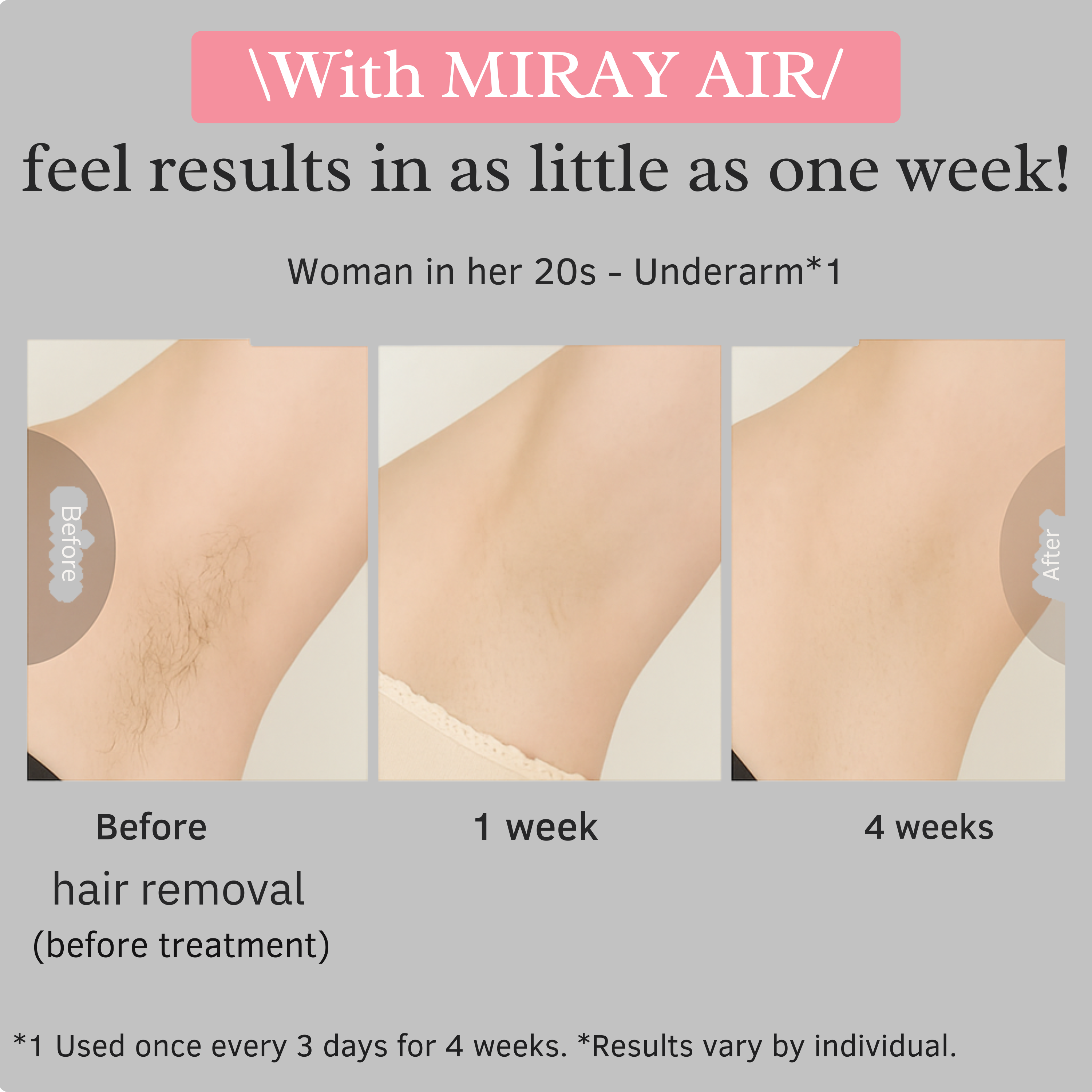 MYTREX Miray Air