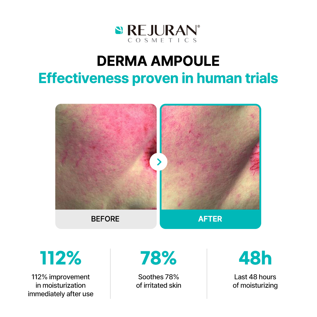 Rejuran® Moisture Treatment Ampoule 30mL