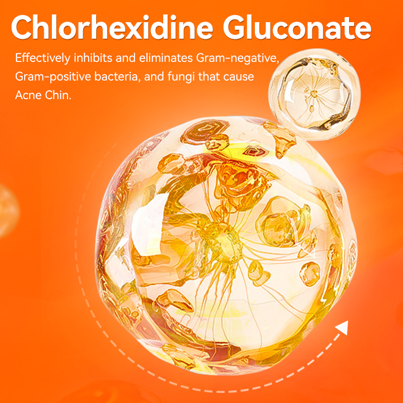  Cat's Black Chin Cleanser, Cleaning Greasy/Oily Chin and Removing Feline Acne