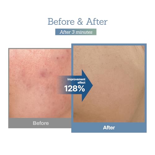 [MEDITHERAPY] Blue Centella Calming Cream 1+1