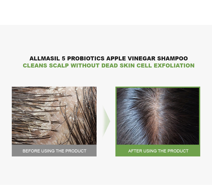 ALLMASIL: 5 Probiotic Apple Vinegar Shampoo