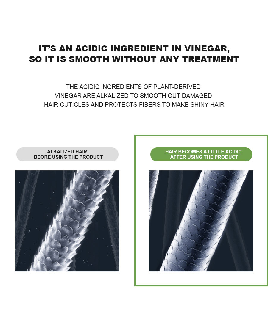 ALLMASIL: 5 Probiotic Apple Vinegar Shampoo