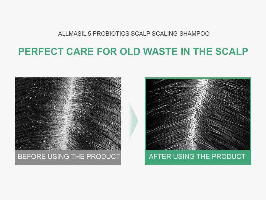 ALLMASIL: 5 Probiotic Scalp Scaling Shampoo