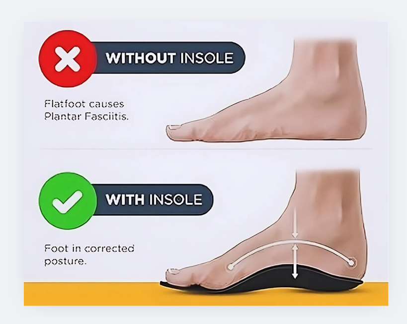 The Connection Between Diabetic Foot and Insoles-HAPPY WALKER