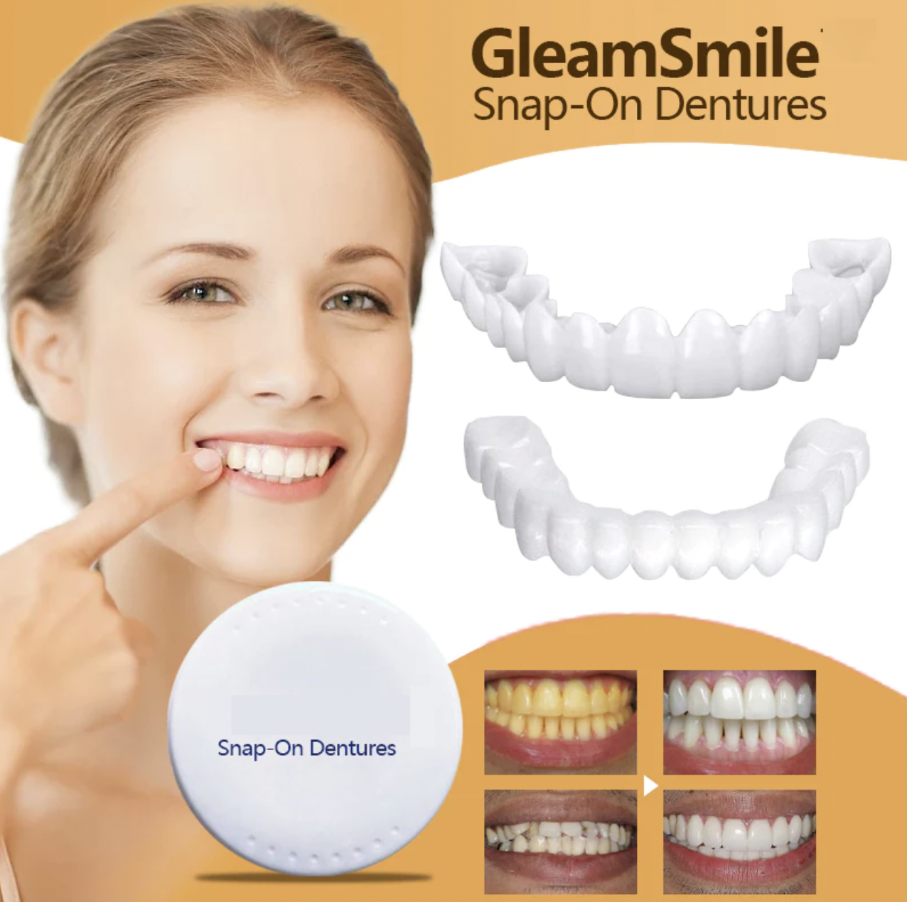 Adjustable Snap-On Dentures