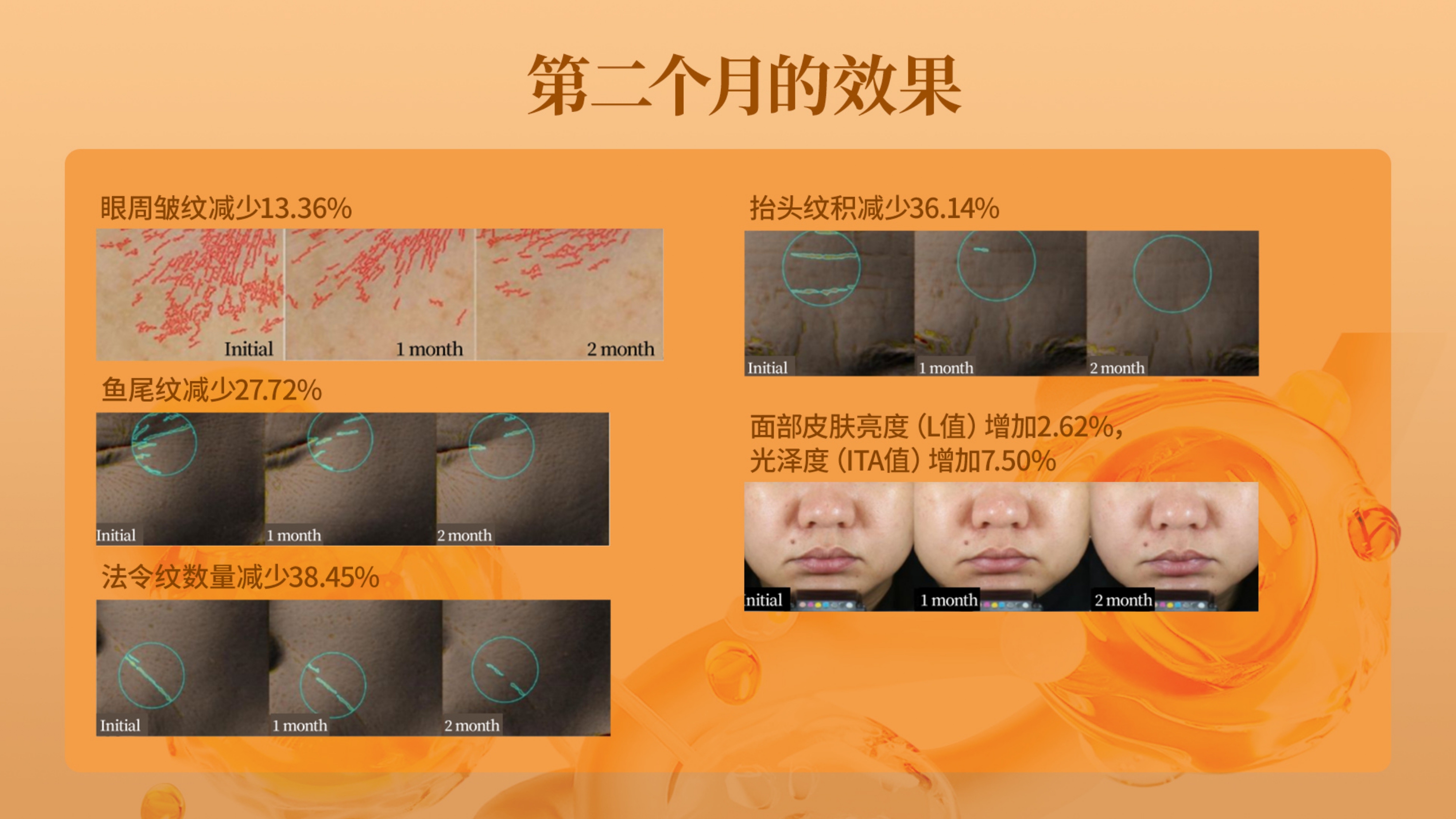 Y13 - NMNactiv 25ML(15 SACHETS )-huwagroup