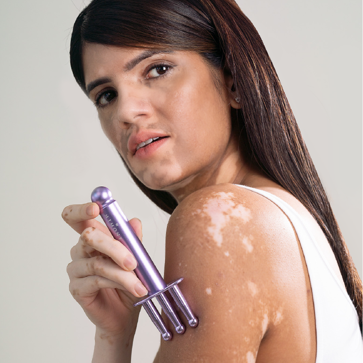 MIMONET Fork -MIMONE