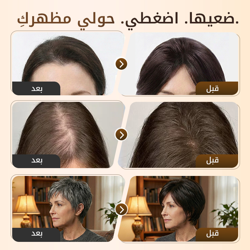 🥰شعر مستعار جزئي للغرة