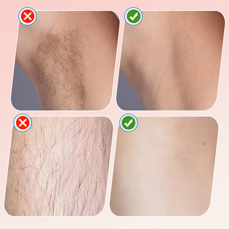 ماكينة حلاقة كهربائية نسائية لاسلكية 2 في 1