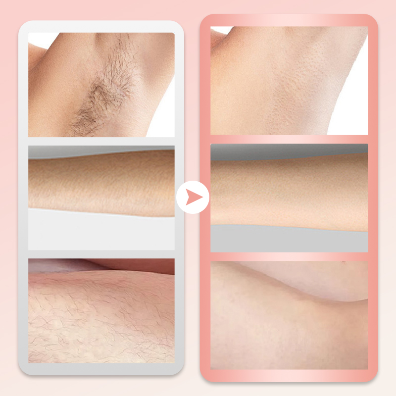 ماكينة حلاقة كهربائية نسائية لاسلكية 2 في 1