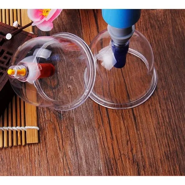 Bộ Giác Hơi Chân Không 32 Cốc Không Dùng Lửa Wisezen Giác Hơi Chân Không Tri Liệu Thư Giãn Chính Hãng