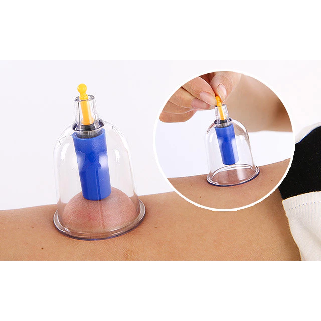 Bộ Giác Hơi Chân Không 32 Cốc Không Dùng Lửa Wisezen Giác Hơi Chân Không Tri Liệu Thư Giãn Chính Hãng