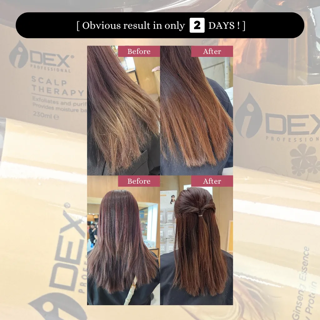 ID0018 IDEX Scalp Therapy 3 in 1 Package