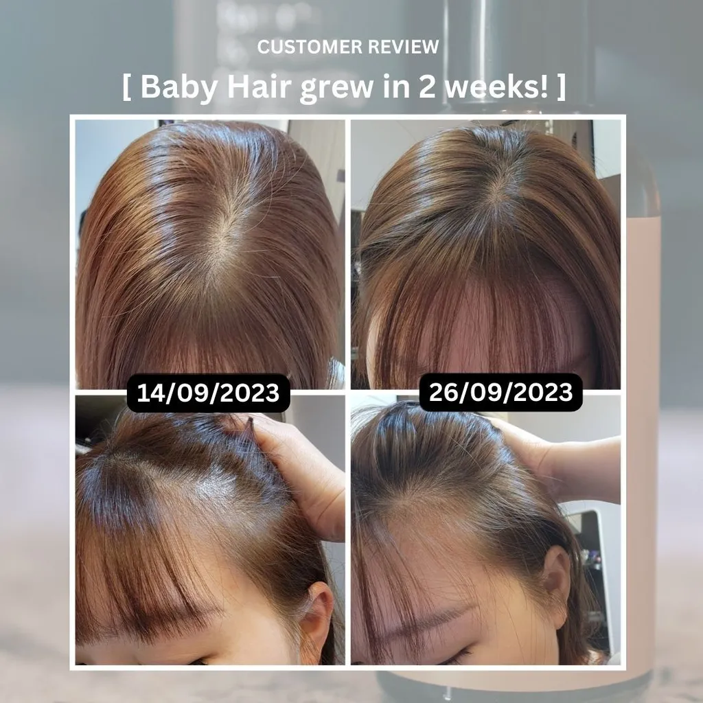 ID0018 IDEX Scalp Therapy 3 in 1 Package