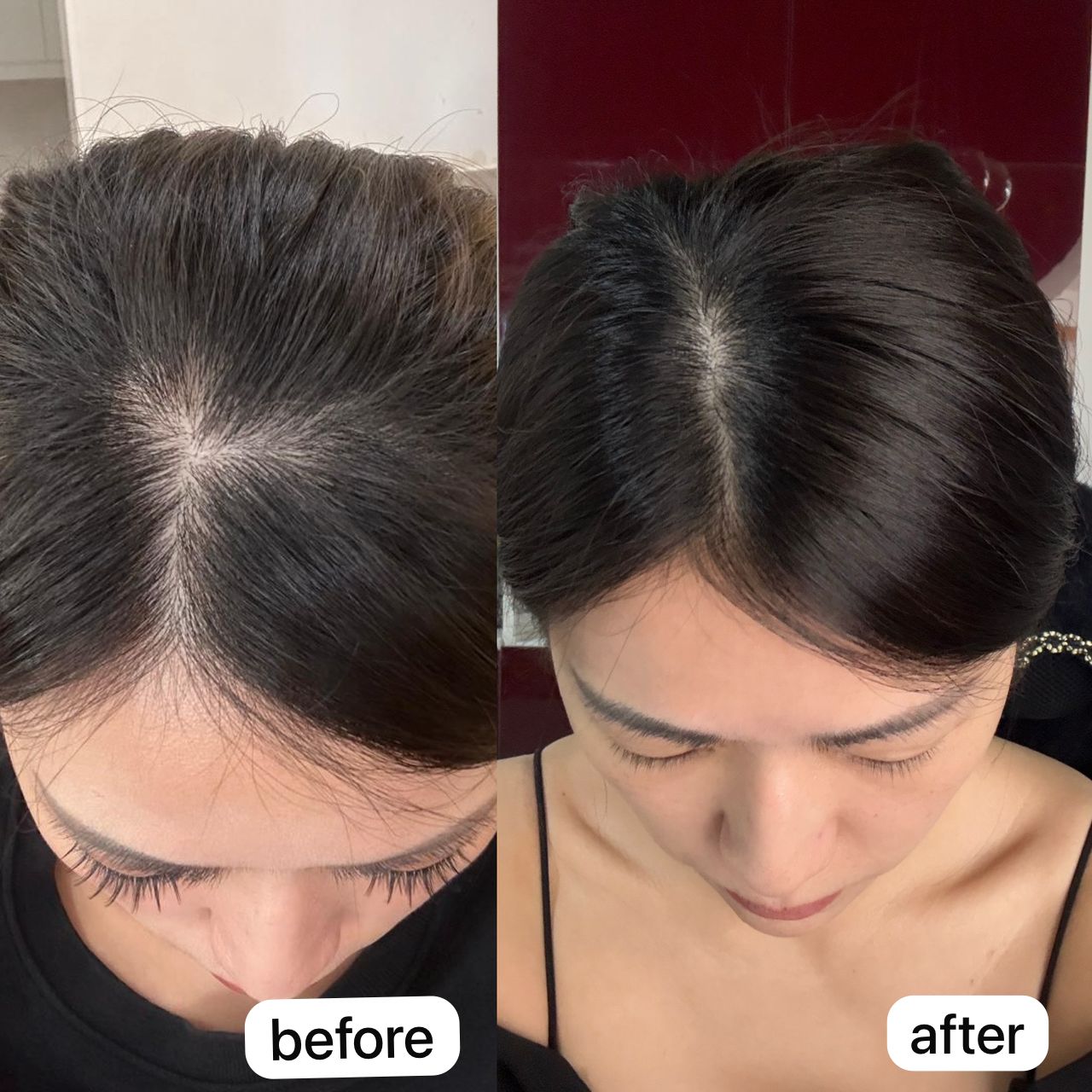 ID0018 IDEX Scalp Therapy 3 in 1 Package