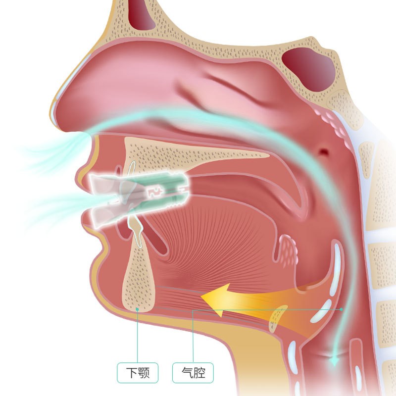 优古耐止鼾器牙套二代助眠呼吸防打鼾阻消防止打呼噜鼻鼾睡觉-Digicat 猫电澳洲