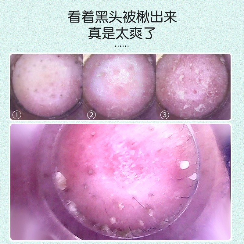 金稻可视吸黑头仪 电动吸毛孔清洁器小气泡吸出粉刺去黑头仪器-Digicat 猫电澳洲