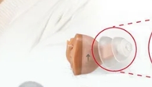 補聴器