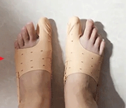 矯正シューズ