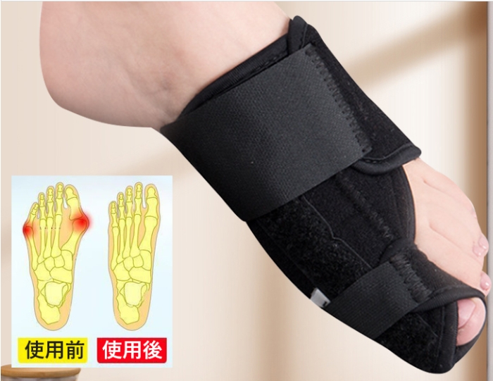 整形外科用ストラップ