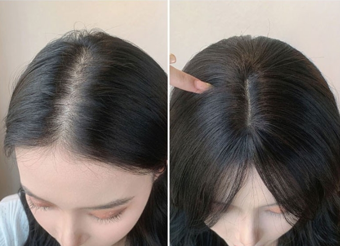ヘアパッチ
