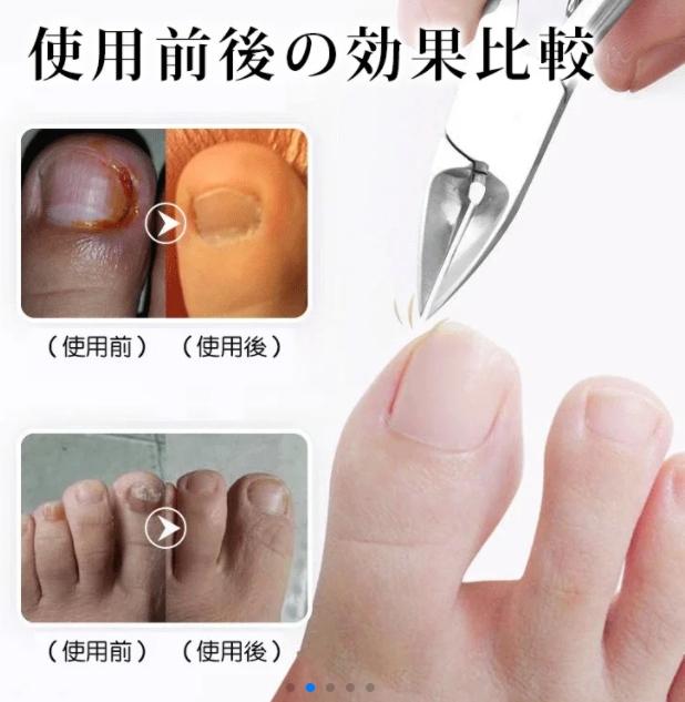 ペンチ
