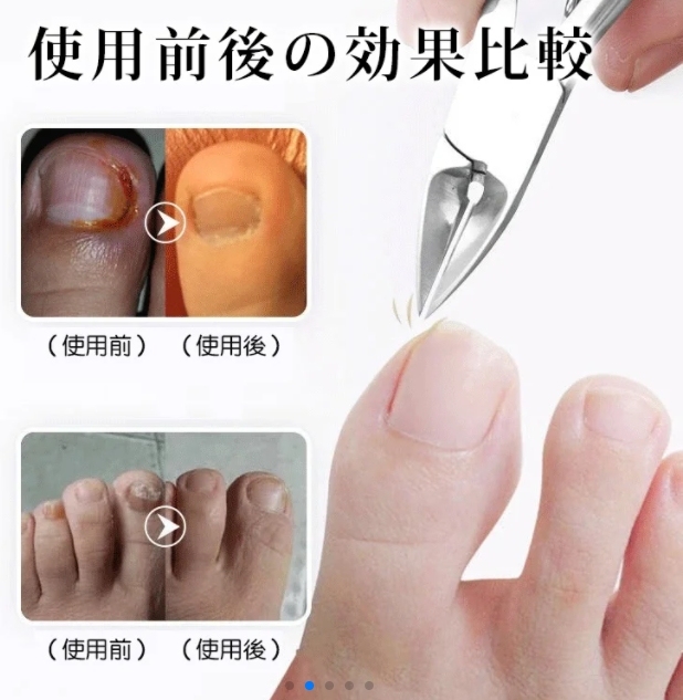 ペンチ