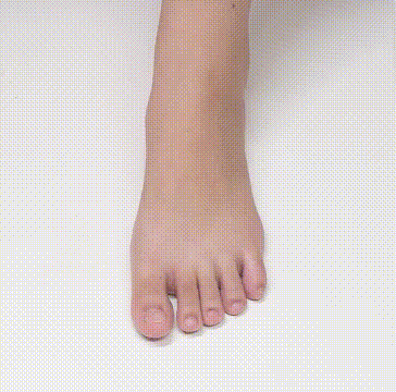 外反母趾スリーブ