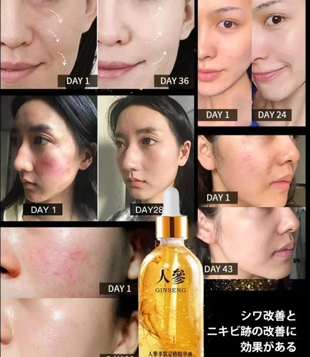 エッセンス