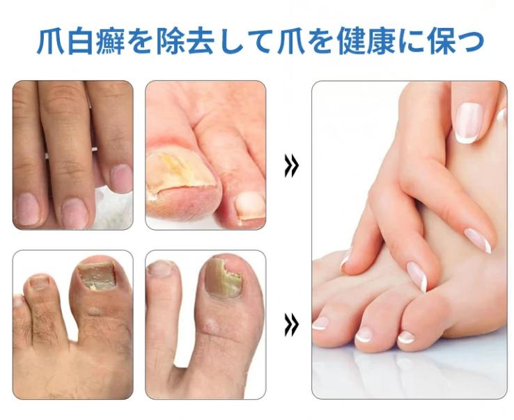 しょうしゃけい