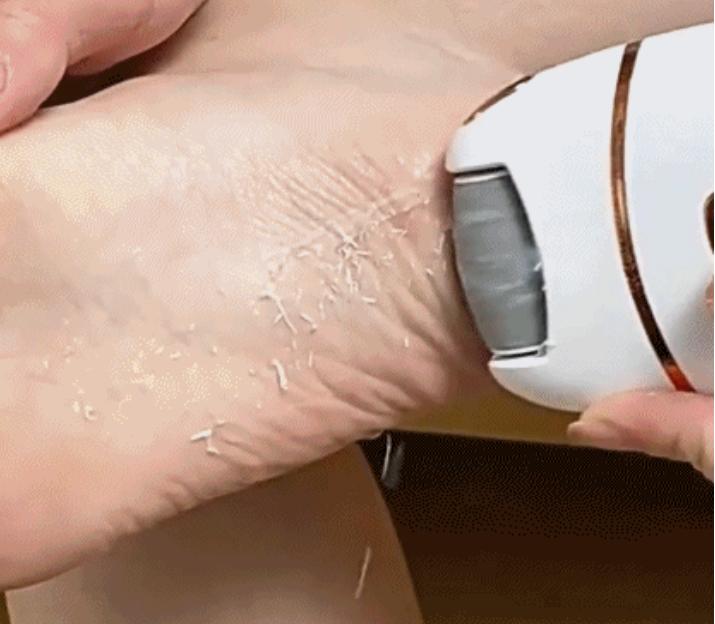 フットシャープナー