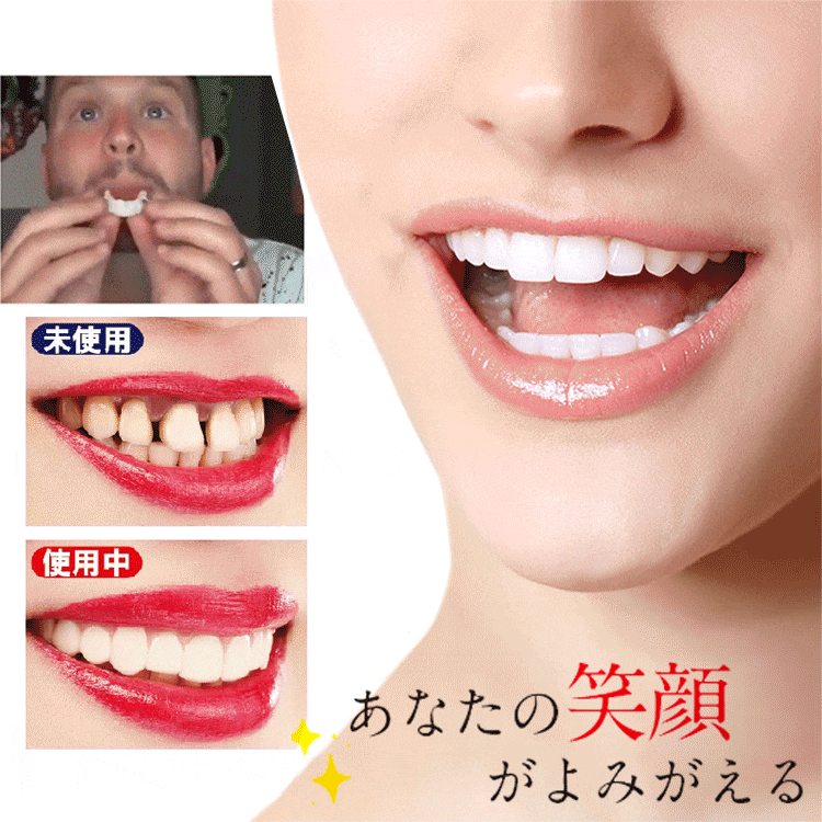 シミュレーション・ブレース
