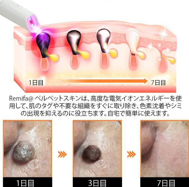いぼ取り筆