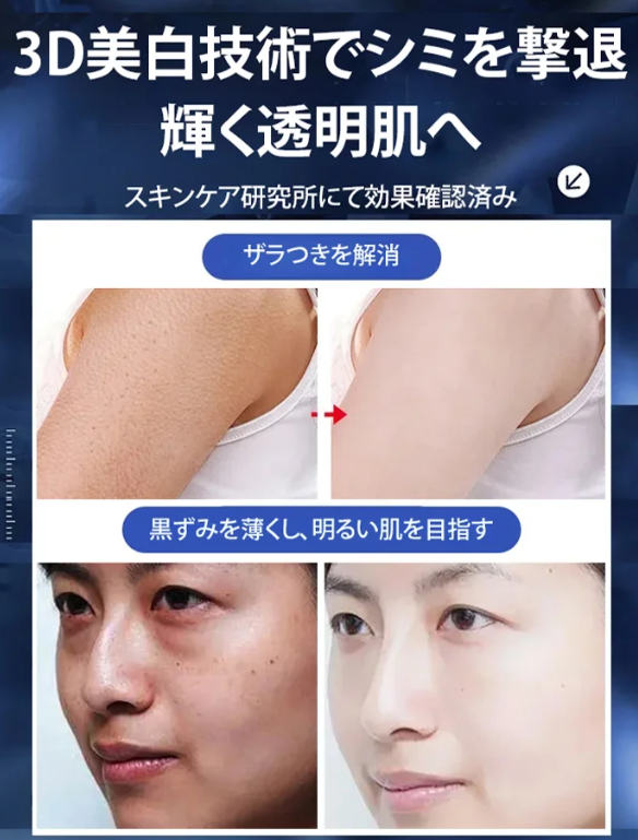 シミ取り尿素クリーム