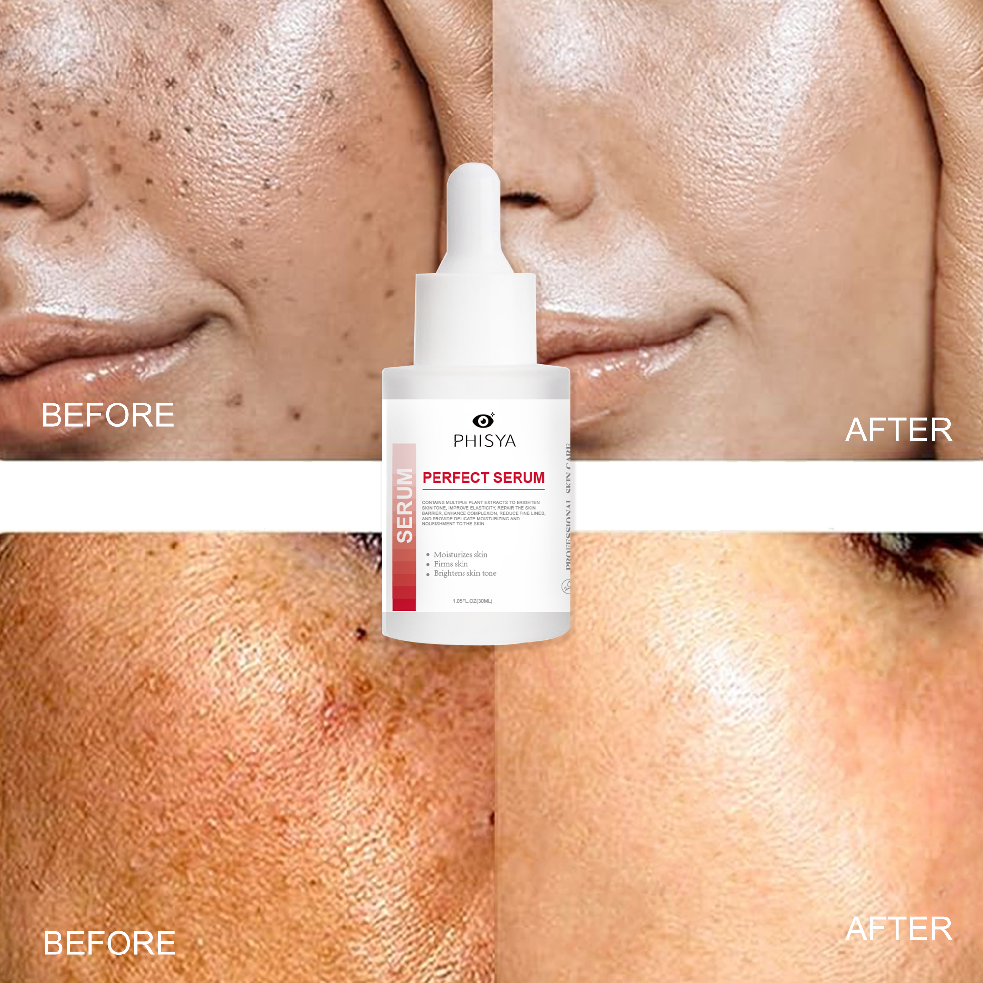 Whitening Brightening Skin For Removing Dark Spot 7 Days Working Effect Face Serum With Niacinamide Alpha Arbutin Radiant Serum