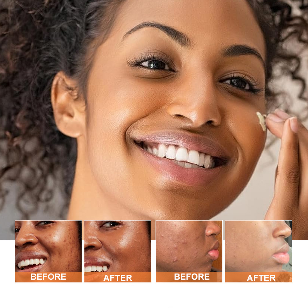 Cosmetics Wholesale Anti-Aging Anti-Acne Moisturizing Vitamin C Turmeric Skin Care Facial Cream