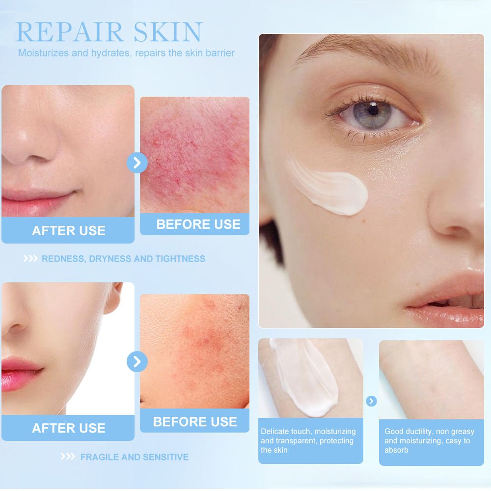 Hot Sale Natural Centella Asiatica Calming Gel Cream For Face Repairing Acne-prone Treatment For Sensitive Skin Care Cream