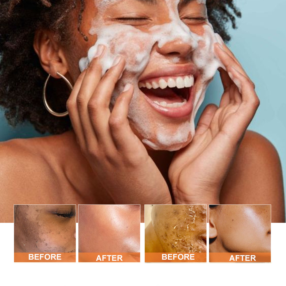 PHISYA Whitening Brightening Facial Cleanser For Acne Skin With Turmeric Vitamins Aloe Vera Gel Amino Acid Foaming Cream