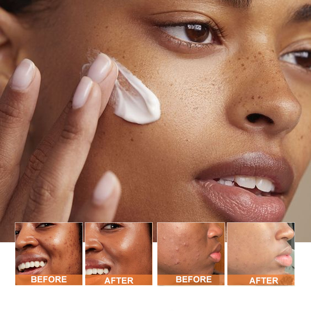 PHISYA Organic Turmeric Mud Facial Mask Moisturizing Nourishing Skin Firming Anti Aging Wrinkles Removal Magic Mask