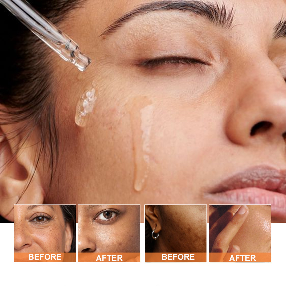 PHISYA Organic Turmeric Oil Moisturizing Nourishing Skin Firming Anti Aging Wrinkles Removal Best Seller Face Oil