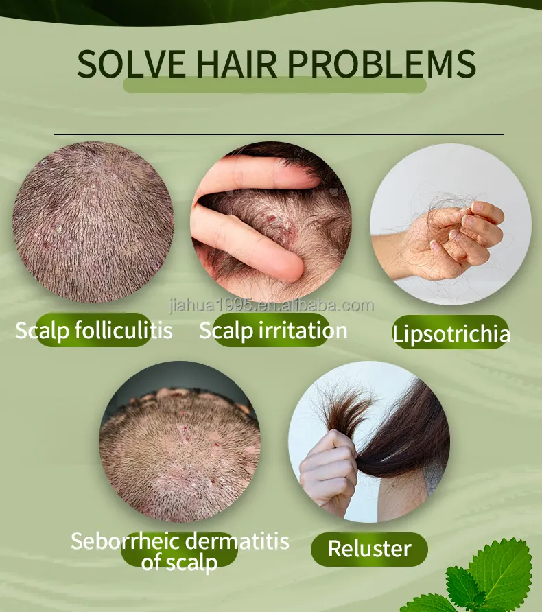 Paraben Free Natural Curly Hair Care Products For Men and Women Anti-dandruff, anti-itch anti-hair loss and firm hair Shampoo -Guangzhou Jahwa Cosmetics co.,Ltd