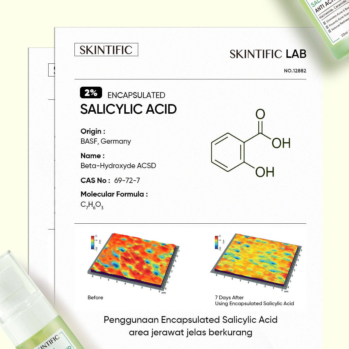 2% Salicylic Acid Anti Acne Serum