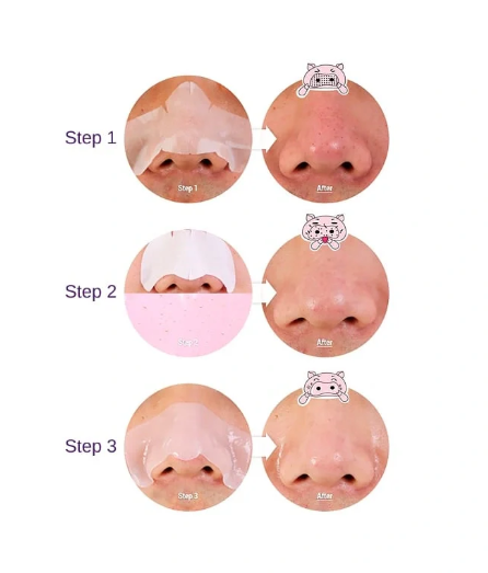 豬鼻貼 Pig-Nose Clear Blackhead 