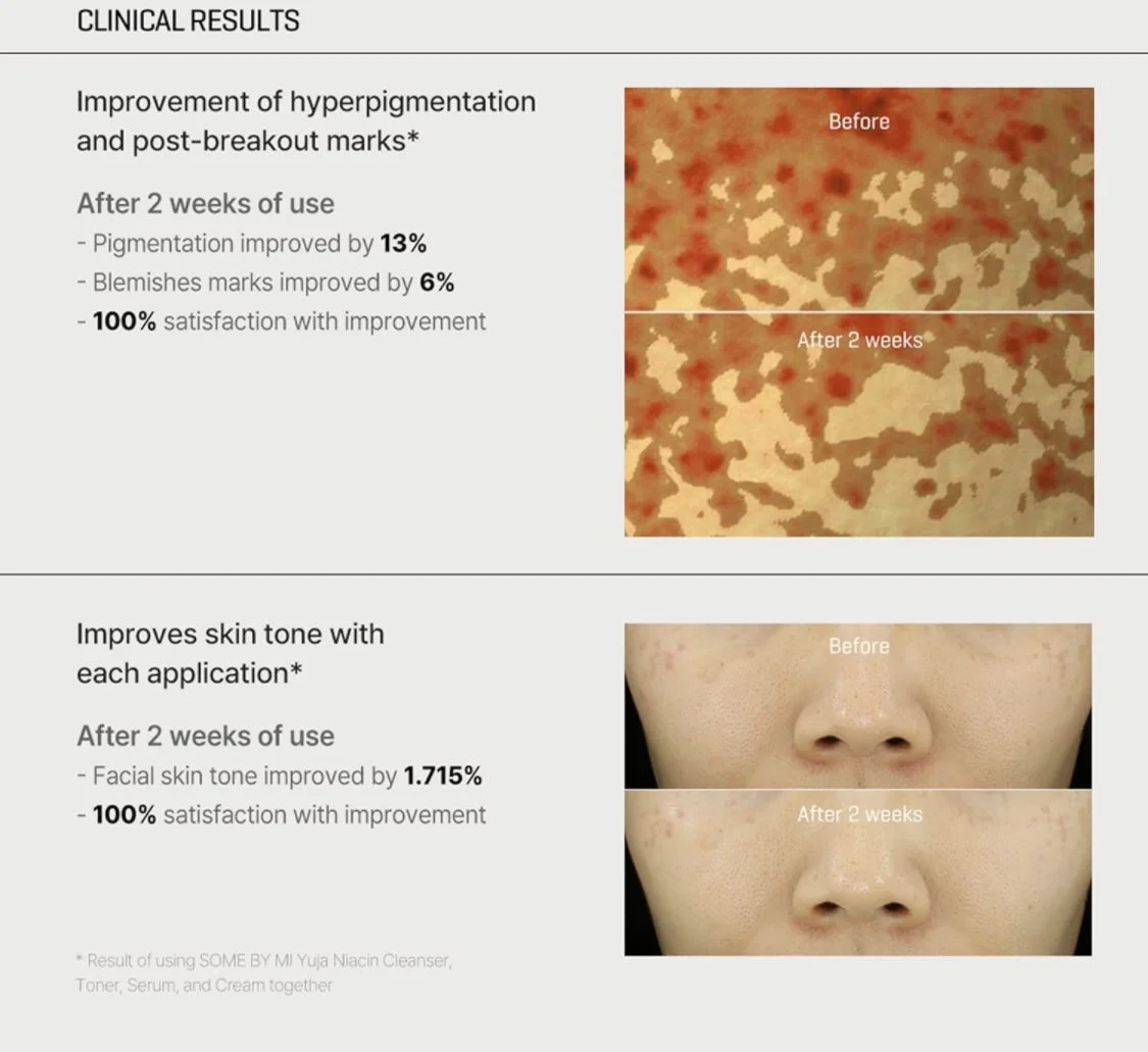 Some By Mi-Yuja Niacin Anti Blemish Cream柚子亮白抗斑面霜 60g