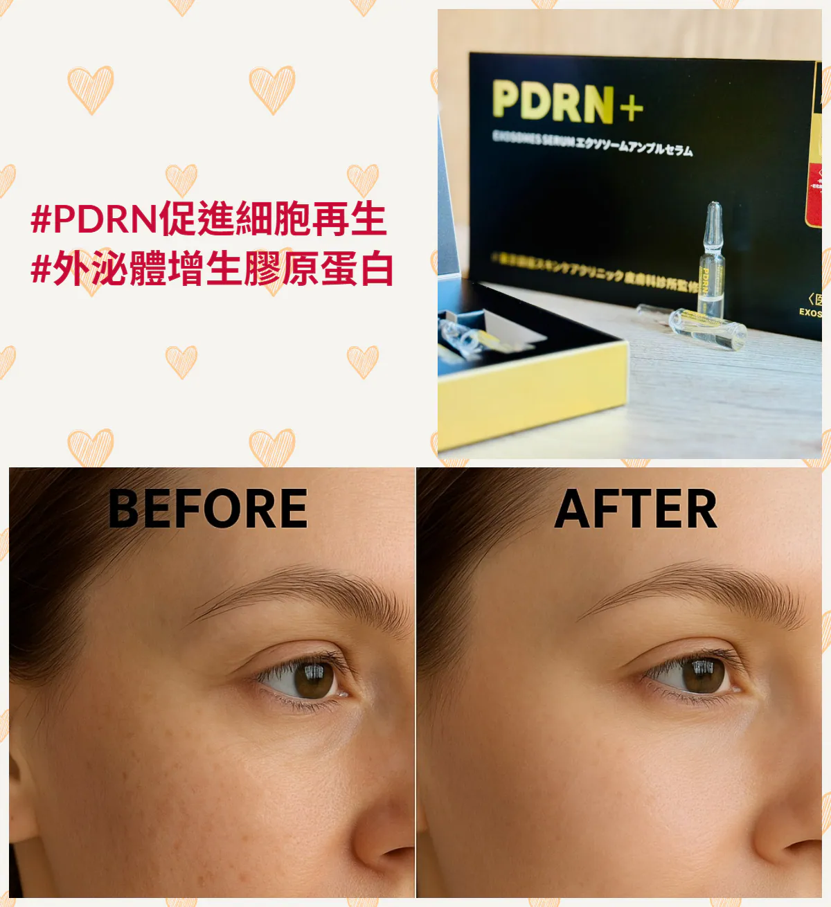 東京銀座安瓶系列-PDRN+外泌體修護安瓶-10入/盒  