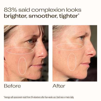 Trilogy Vitamin C+ Super Serum 30ml
